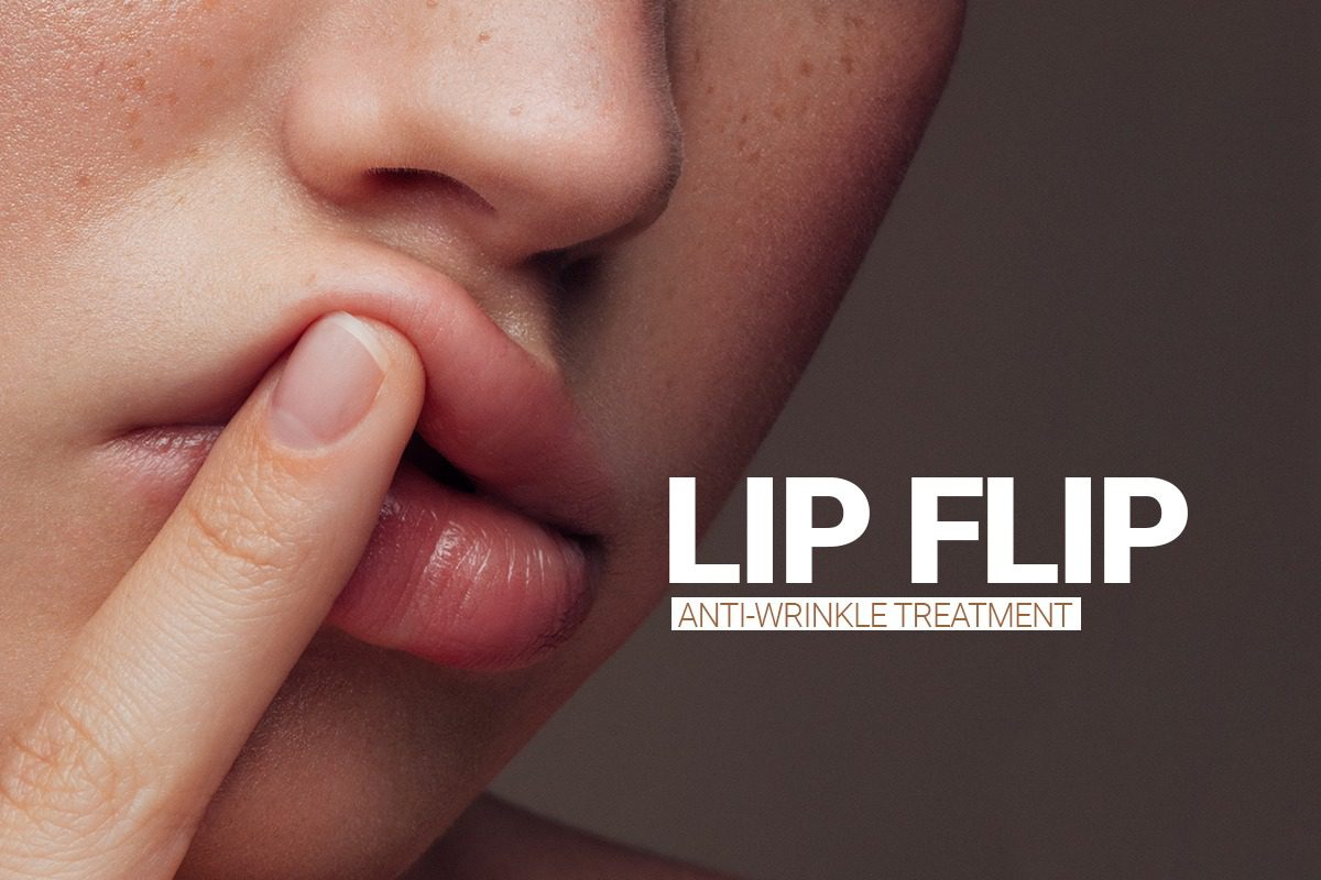 Lip Flip Treatment